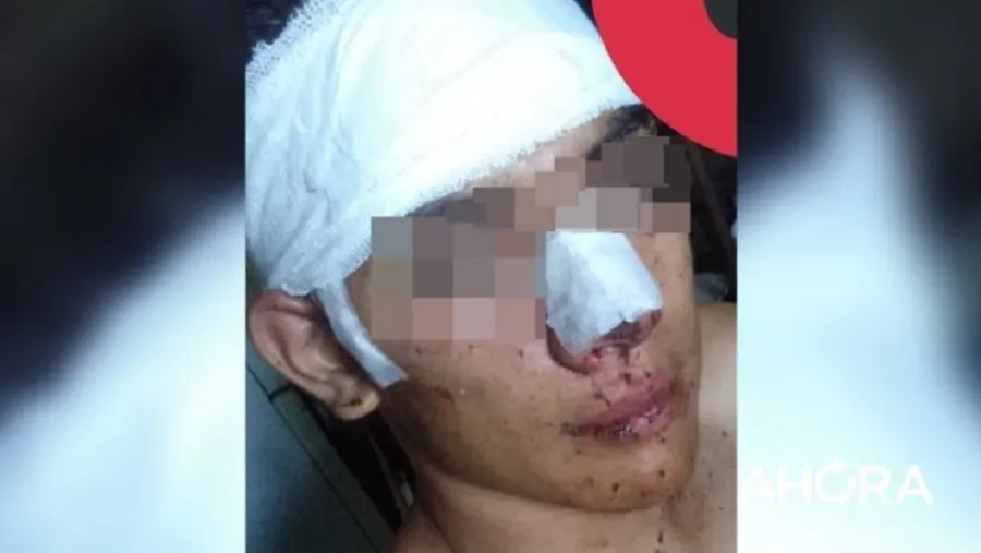 Joven golpeado