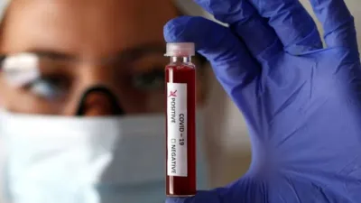 coronavirus 