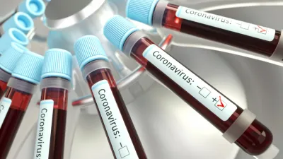 coronavirus laboratorio